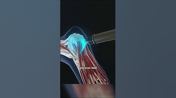 Shockwave Therapy (3D Animation) #drone #theflash #space #automobile #scifi #humanhand #abstruct