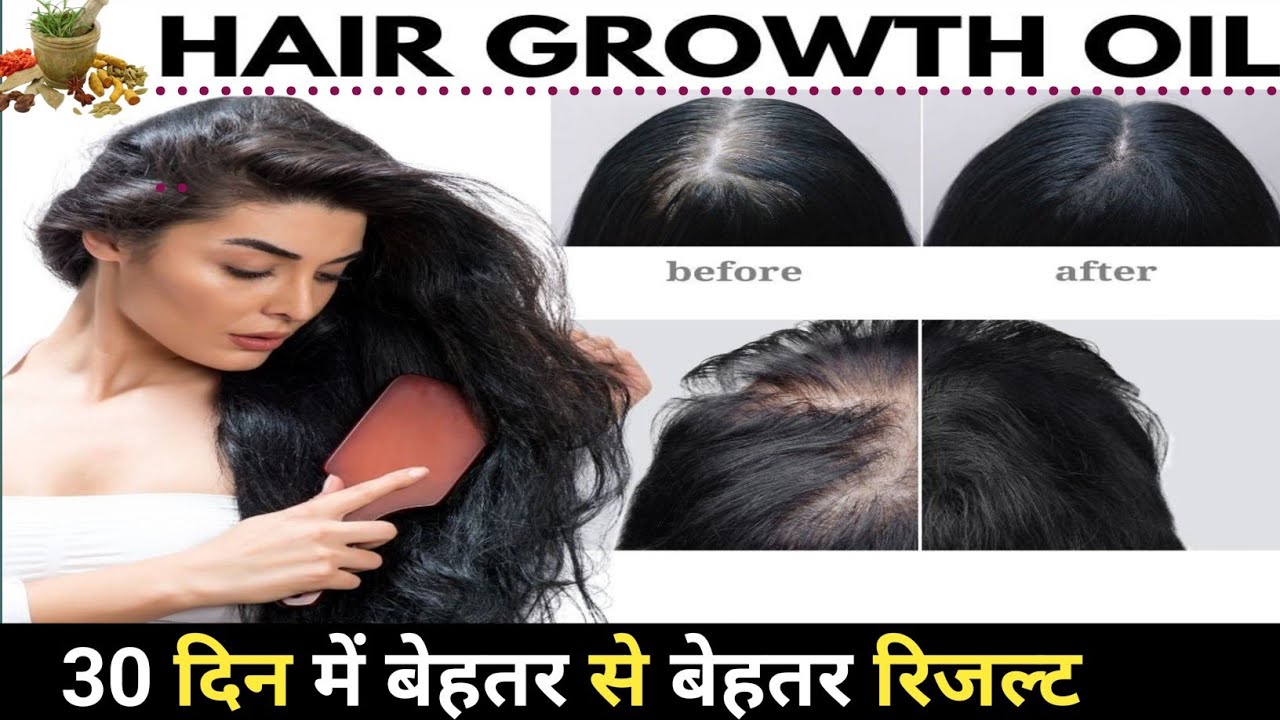 Ayurvedic Hair Oil for Hair Growth | 100% Natural Oil to Stop Hair Fall & Regrow Hair Naturally।।