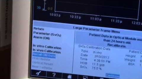 Revised Continuous Cardiac Output Monitor Recall OM Data