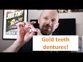 Gold Teeth Dentures A Discussion Gold Teeth Dentures A Discussion