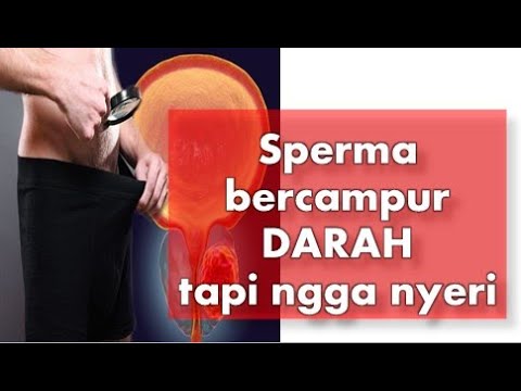 penyebab-sperma-bercampur-darah-tapi-tidak-nyeri-dan-cara-mengatasinya!!!