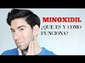 MINOXIDIL ¿Que es y como funciona? - J.M. Montaño