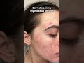 I can’t believe that cleaning make up brushes fixed my acne! 🥰 Link in bio!