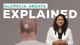 Alopecia Areata: Explained!