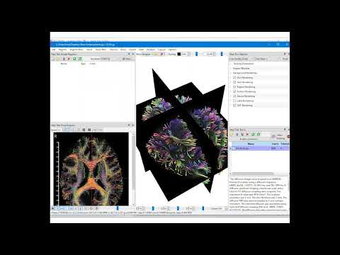 Differential Tractography for Cross Sectional and Longitudinal Studies