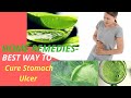 BEST Way To Cure Stomach Ulcer Permanently.