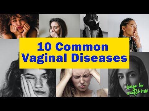 10 सबसे आम योनि रोग / महिलाओं की समस्याएं | कारण | लक्षण