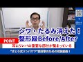 【整形級のBefore/After】さとう式「耳リンパ毒だし」でシワ・たるみ全消し！老化にサヨナラする最強ケア【厳選切抜き】さとう式リンパケア取扱い動画