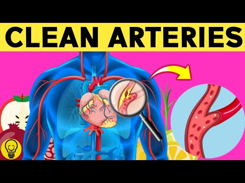 Top 7 Foods that Unclog Arteries Fast and Prevent Heart Attack Naturally