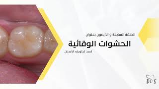 47 الحشوات الوقائية screenshot 4