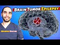 Brain Tumors and Epilepsy. Completely Different Treatment