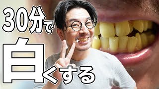 ホワイトニングシートで黄色い歯を白くできるか試してみた結果