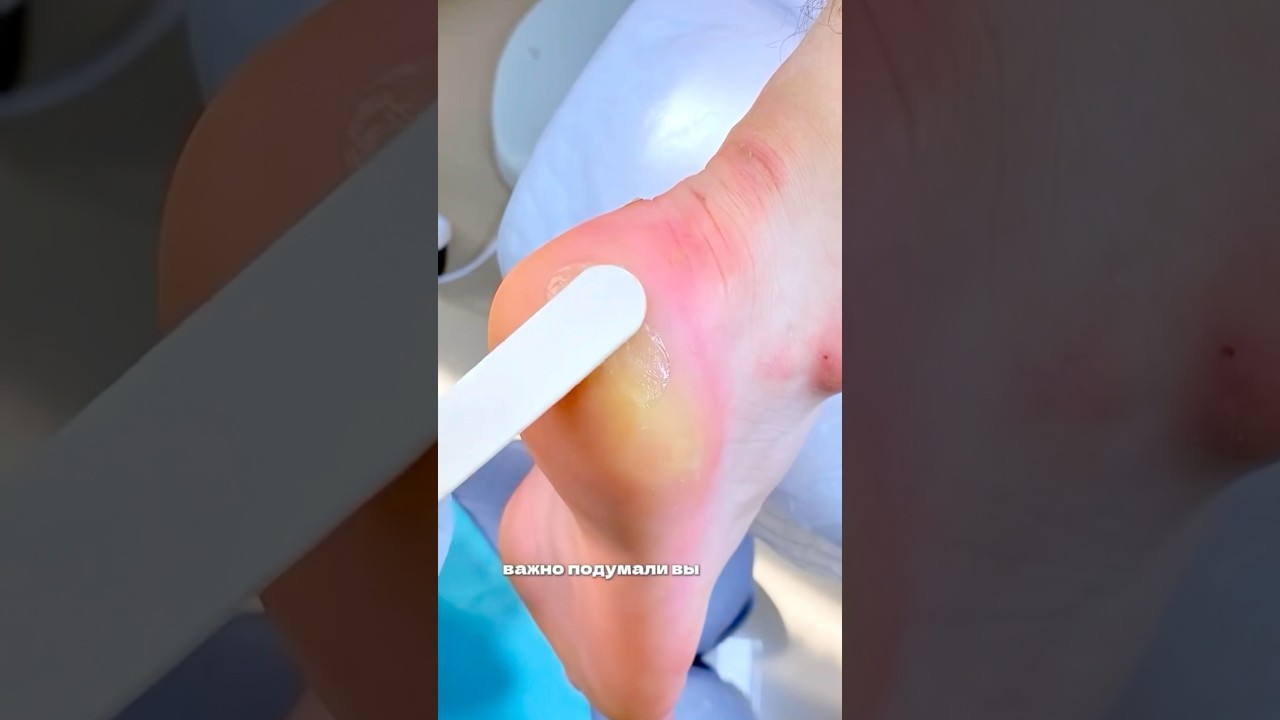 “Secret DIY Trick for Smooth & Beautiful Heels!