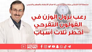 د. جميل القدسيرعب نزول الوزن في القولون التقرحي أخطر ثلاثة اسباب