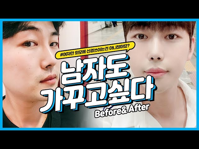 [남자성형전후] 남자도 가꾸고싶다!! 남자윤곽수술,코성형결과 (여자만 외모에 신경쓰는 건 아니잖아요?)