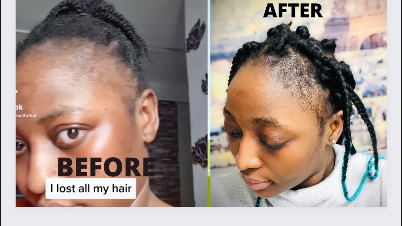 HOW TO GROW YOUR EDGES FAST