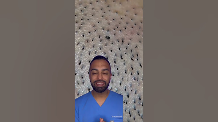 Pili multigemini… Apa itu?! 😱 Dr Somji menjelaskan