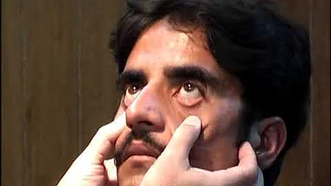 Prof Farrukh Iqbal General Physical Examination