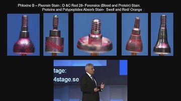Dr Chandhur Wadwhani : les risques de réutilisation des  piliers de cicatrisation