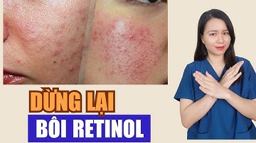 Ngừng lại dùng Retinol: chỉ làm da sần sùi, nổi mụn, sạm nám | Nguyễn Mai Hương