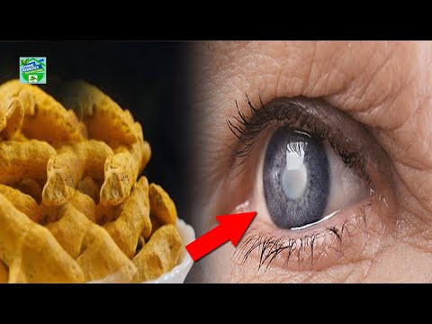 Video: Varför är surma bra för ögat?