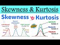 What Is Skewness Kurtosis Difference Between Skewness And Kurtosis In Statistics 
