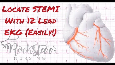 Locate and interpret STEMI based on 12 Lead EKG