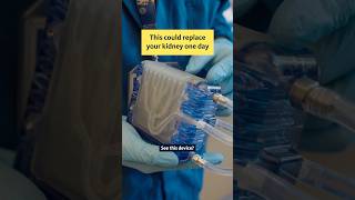This device could replace your kidney