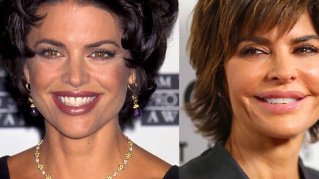 50 Celebrities who Destroyed Themselves with Plastic Surgery YouTube