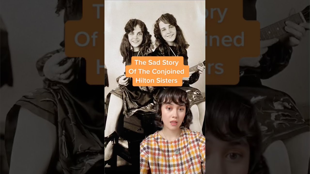 The Sad Story Of The Conjoined Hilton Sisters