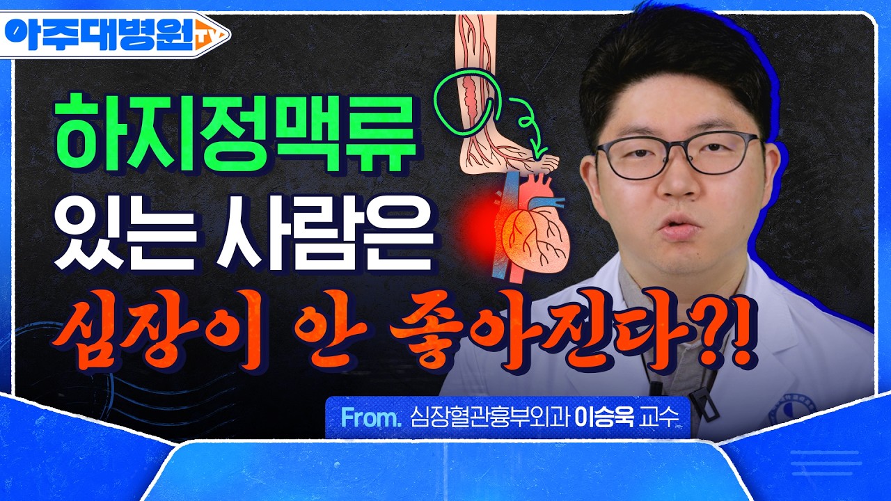 흉부외과 교수曰 "하지정맥류, 무서운 병 아닙니다!“ 초기 증상·원인·치료법 총정리😎 | 심장혈관흉부외과 이승욱 교수
