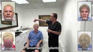 Dr. Brett Bolton patient Patrick MaxHarvest™ procedure