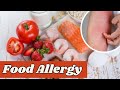 How To Deal With Food Allergy #foodallergy
