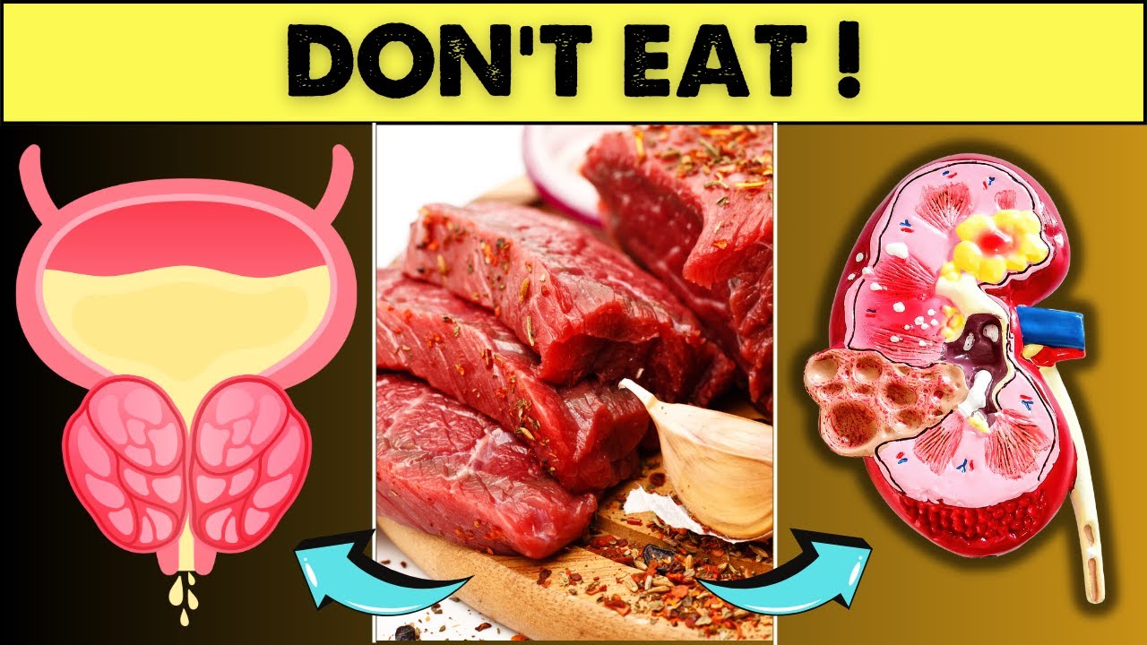 DON T EAT 5 Foods That DESTROY The Prostate Gland And HARM The Kidneys DON T EAT 5 Foods That DESTROY The Prostate Gland And HARM The Kidneys