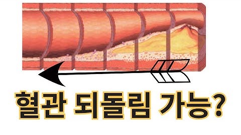 동맥경화 타임머신 프로젝트. 나이들수록 점점 좁아지는 혈관 다시 되돌릴수 있나요?