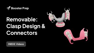 Prosthodontics | Removable: Clasp Design & Connectors | INBDE, NDEB, ADAT