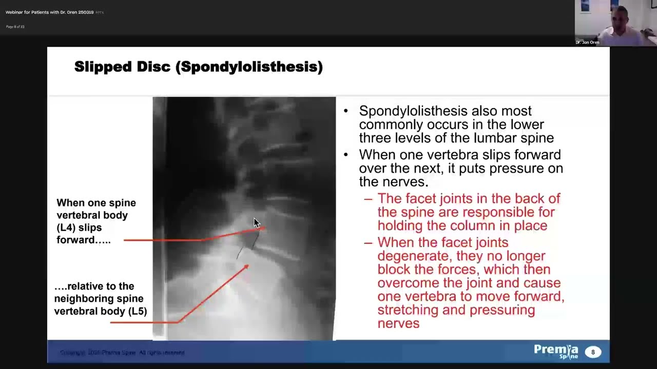 Dr. Jonathan Oren - TOPS™ System Webinar