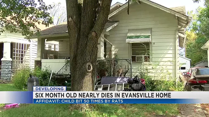 Affidavits: Baby nearly dies after being found with more than 50 rat bites, nearly missing finger...