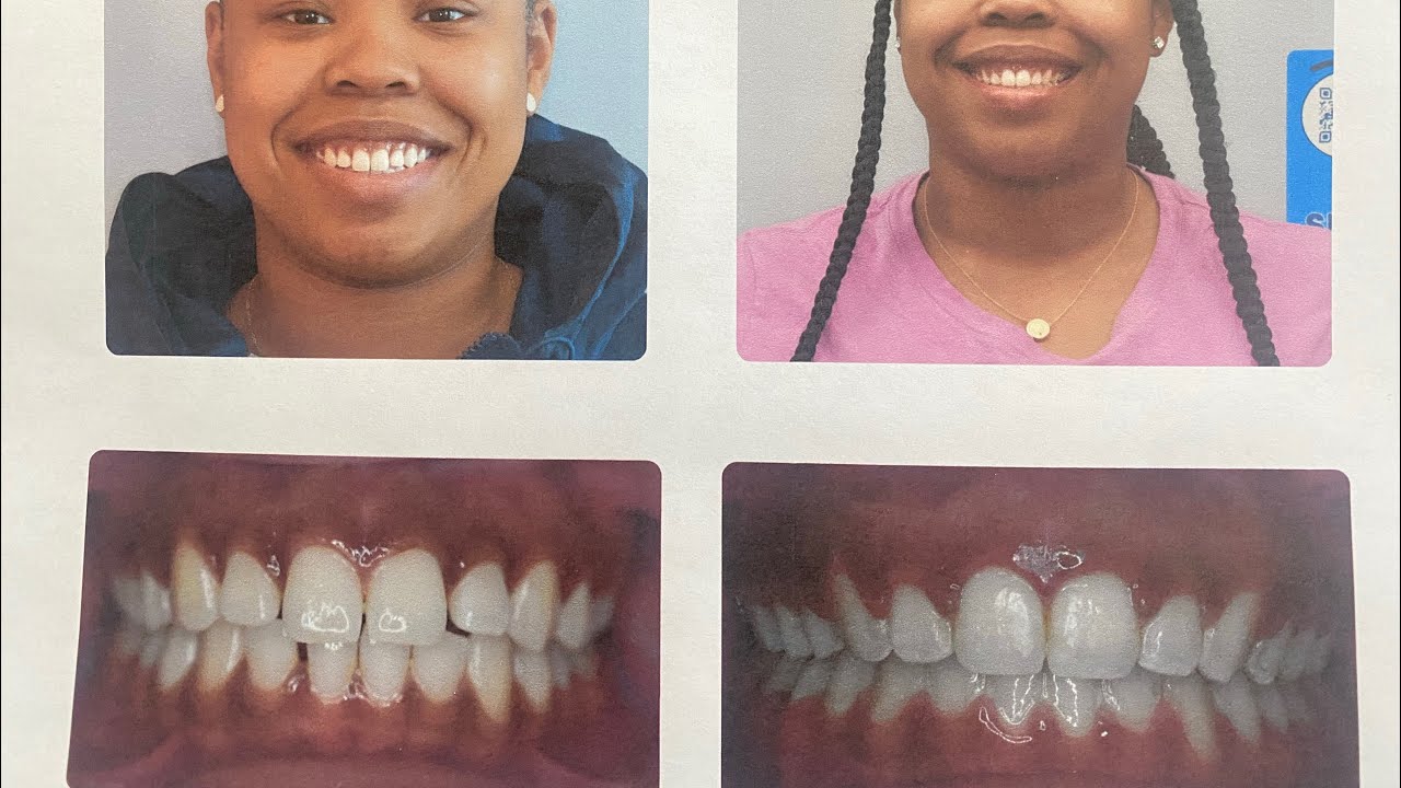 Orthodontist Experts Review 🎈 ️ Location Hilside , Illinois YouTube