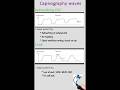 Capnography waves 🩺#aiims #mrb #rrb#jipmer #esic #all competitive exams 🩺