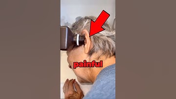 Bug Found Inside Ear 😱