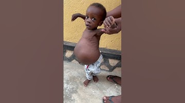 Ethan needs a someone to help him get treatment. He is also in Pain. #baby #shorts