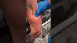 Celebrity Tricep #muscletwitch Wealth