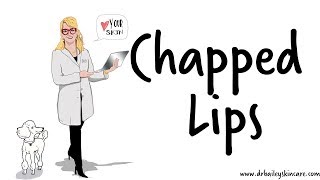Chapped Lips? Healing Tips from Dermatologist - Dr. Bailey Skin Care (2017) Net Worth