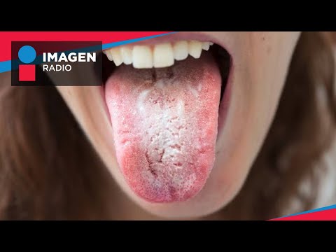 Enfermedades y alteraciones más comunes de la lengua