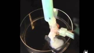 New Catheter Design Reduces Threat of Infection