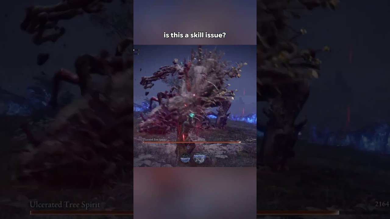 Is This A Skill Issue in Elden Ring?