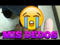 ⚠️🆘ACCIDENTE LABORAL⚠️🆘 CASI PIERDO LA MANO ENTERA 😱 Esta es MI HISTORIA