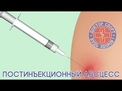 Доктор Спорт «Постинъекционный Абсцесс»