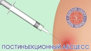 Доктор Спорт «Постинъекционный Абсцесс»